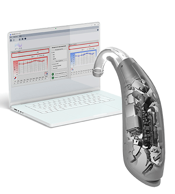 Индивидуальная настройка слухового аппарата в Таганроге
